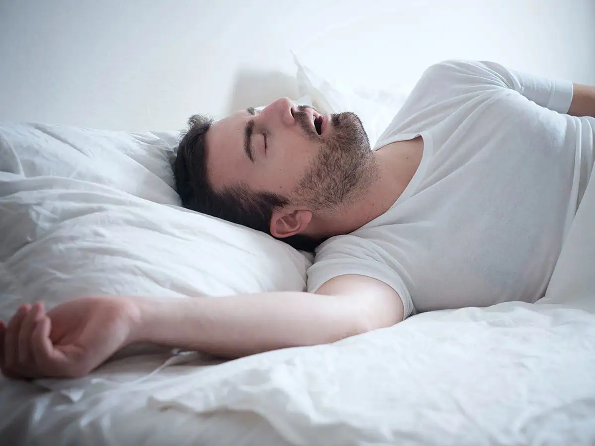 Сънна апнея